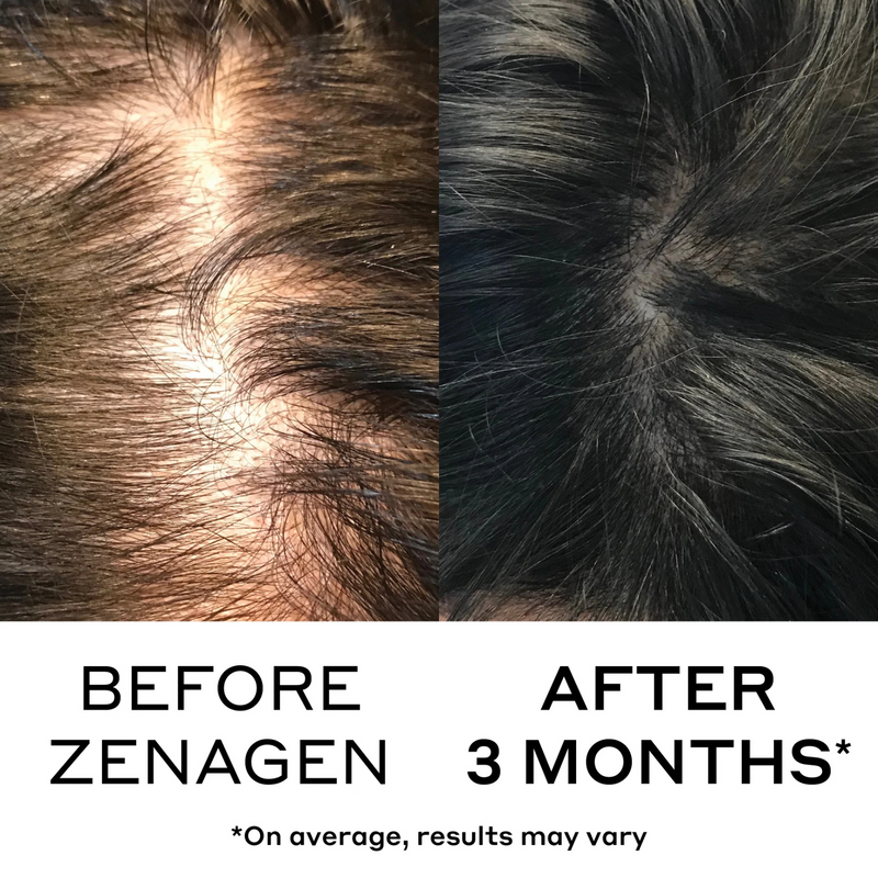 Densifying Hair Serum