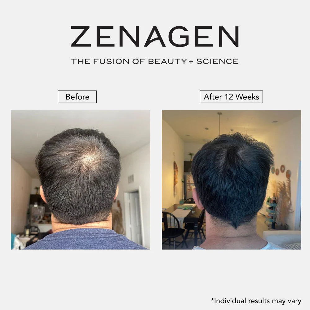 Revolve  MEN'S Hair Growth Kit