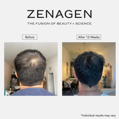 Revolve  MEN'S Hair Growth Kit