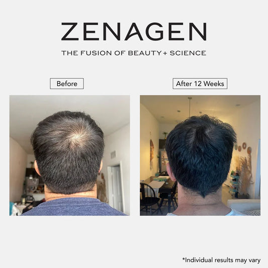 Revolve  MEN'S Hair Growth Kit